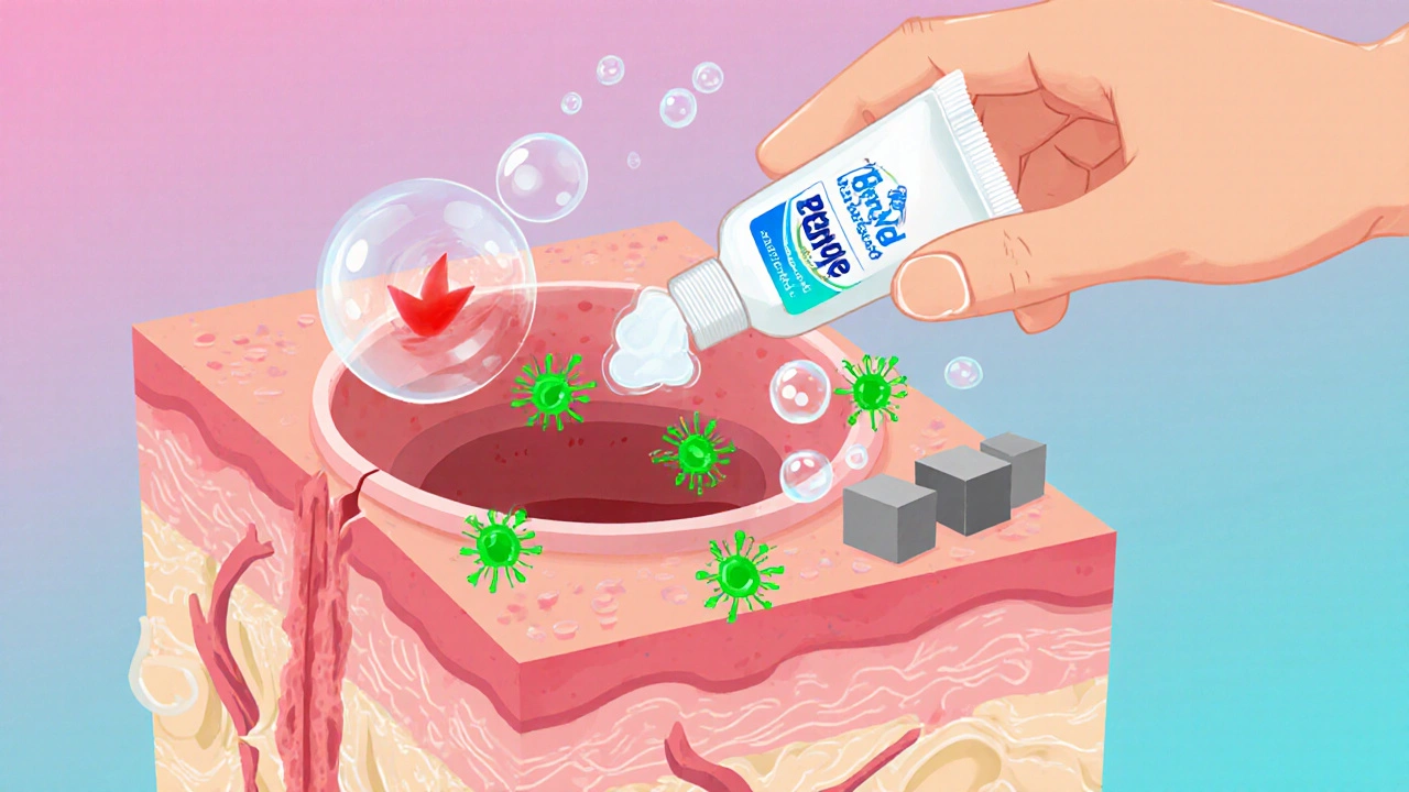 Illustrated skin pore with oxygen bubbles from Benzac AC Gel destroying bacteria and exfoliating cells.